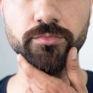 نکات مهم در انتخاب متخصص کاشت ریش و سبیل