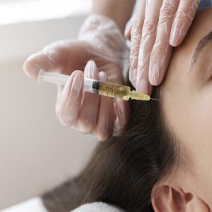 هزینه تزریق پی آر پی موی سر