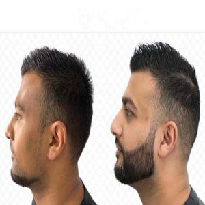 انواع روش های کاشت ریش