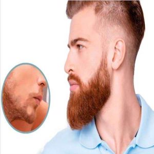 سن مناسب برای کاشت ریش