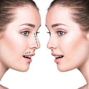 مزایا و معایب استفاده از فیلر بینی