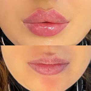 تفاوت لب روسی با لب معمولی