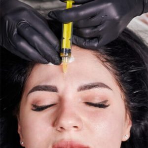 چند روز بعد از تزریق چربی صورت طبیعی میشود