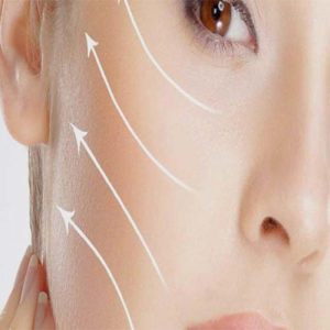 عوارض لیفت شقیقه