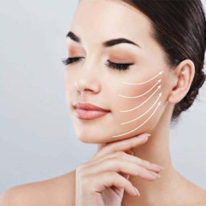 ماندگاری لیفت شقیقه بانخ