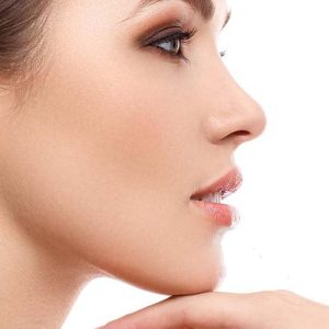 لیفت شقیقه با نخ