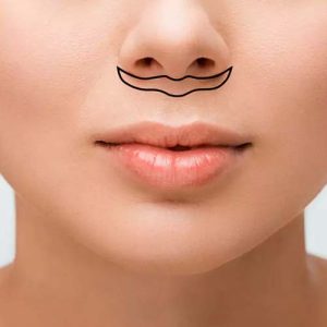 ماندگاری لیفت سانترال لب چقدر است؟