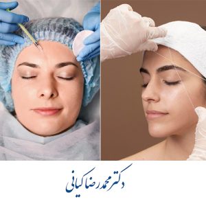 آیا لیفت صورت با نخ از لیفت