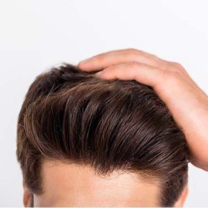 انتخاب متخصص مناسب برای کاشت مو