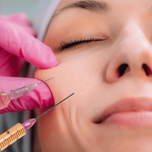 تزریق چربی به گونه
