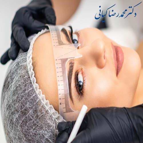 جدیدترین روش کاشت ابرو
