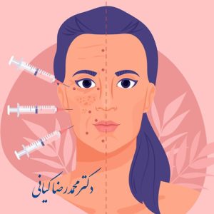 جراحی بوکال فت یا برداشتن چربی چگونه انجام میشود