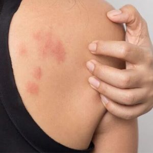 راه های تشخیص ضایعات پوستی