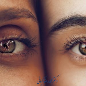 سن مناسب انجام بلفاروپلاستی