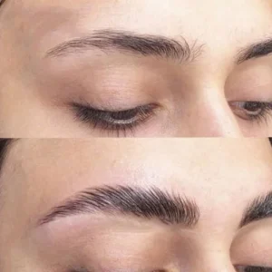 هزینه-لیفت-ابرو-با-نخ
