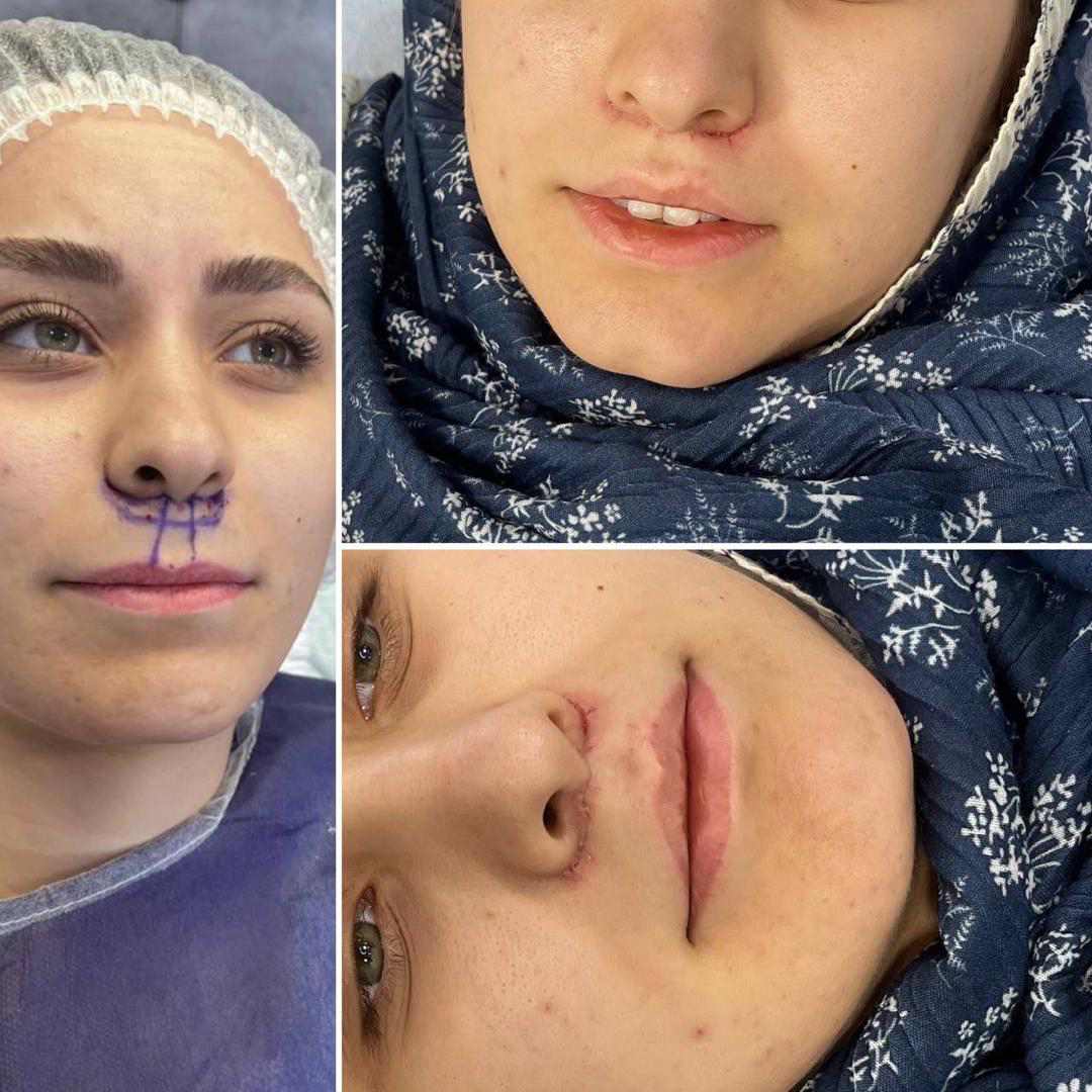 عمل سانترال لب