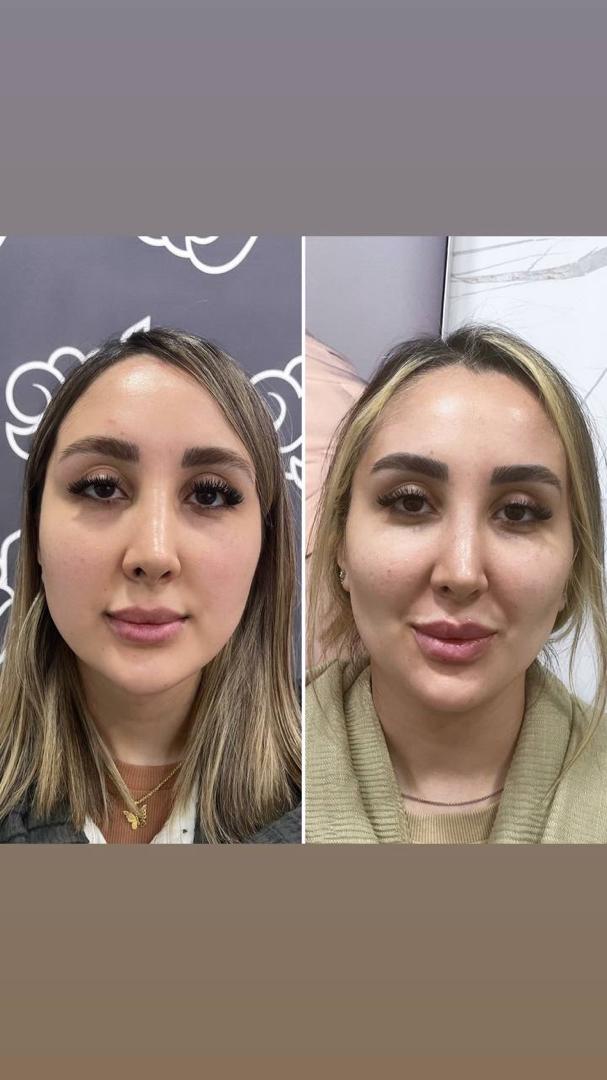 خدمات بوکال فک